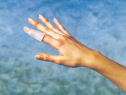 ΠΛΑΣΤΙΚΟ ΝΑΡΘΗΚΑΚΙ ΔΑΚΤΥΛΟY "STAX"