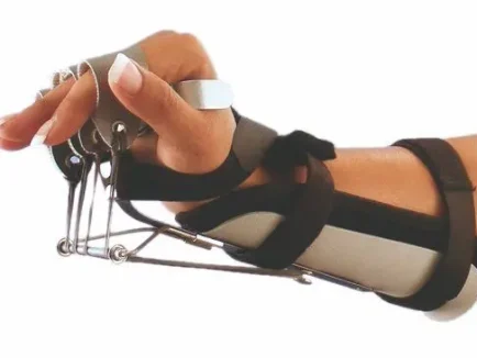 ΔΥΝΑΜΙΚΟΣ ΝΑΡΘΗΚΑΣ ΕΚΤΑΣΗΣ ΚΑΡΠΟΥ ΠΑΛΑΜΗΣ ΜΕΤΑΚΑΡΠΙΩΝ ΜΕ ΕΛΕΓΧΟ ΤΩΝ ΔΑΚΤΥΛΩΝ “COCK UP”