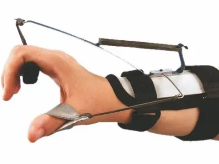 ΔΥΝΑΜΙΚΟΣ ΝΑΡΘΗΚΑΣ ΕΚΤΑΣΗΣ ΚΑΡΠΟΥ ΜΕΤΑΚΑΡΠΙΩΝ ΜΕ ΕΛΕΓΧΟ ΑΠΑΓΩΓΗΣ ΤΟΥ ΑΝΤΙΧΕΙΡΟΣ “THOMAS”