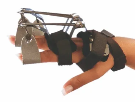 ΔΥΝΑΜΙΚΟΣ ΝΑΡΘΗΚΑΣ ΕΚΤΑΣΗΣ ΜΕΤΑΚΑΡΠΟΦΑΛΛΑΓΓΙΚΩΝ ΑΡΘΡΩΣΕΩΝ ΜΕ ΕΛΕΓΧΟ ΕΚΤΑΣΗΣ ΤΩΝ ΔΑΚΤΥΛΩΝ