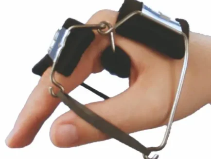 ΔΥΝΑΜΙΚΟΣ ΝΑΡΘΗΚΑΣ ΚΑΜΨΗΣ ΤΩΝ ΜΕΤΑΚΑΡΠΟΦΑΛΑΓΓΙΚΩΝ ΑΡΘΡΩΣΕΩΝ