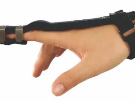 ΝΑΡΘΗΚΑΣ ΑΚΙΝΗΤΟΠΟΙΗΣΗΣ ΔΑΚΤΥΛΟΥ ΣΕ ΘΕΣΗ ΕΚΤΑΣΗΣ “FINGER EXTENSION”