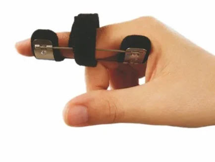 ΝΑΡΘΗΚΑΣ ΕΚΤΑΣΗΣ ΜΕΣΟΦΑΛΑΓΓΕΙΑΣ ΑΡΘΡΩΣΗΣ ΔΑΚΤΥΛΟΥ ΜΕ ΚΕΝΤΡΙΚΟ ΕΡΓΟΝΟΜΙΚΟ ΙΜΑΝΤΑ “PIP”