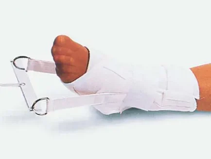 ΥΦΑΣΜΑΤΙΝΗ ΕΠΙΣΤΡΑΓΑΛΙΔΑ ΕΛΞΗΣ ΙΣΧΙΟΥ